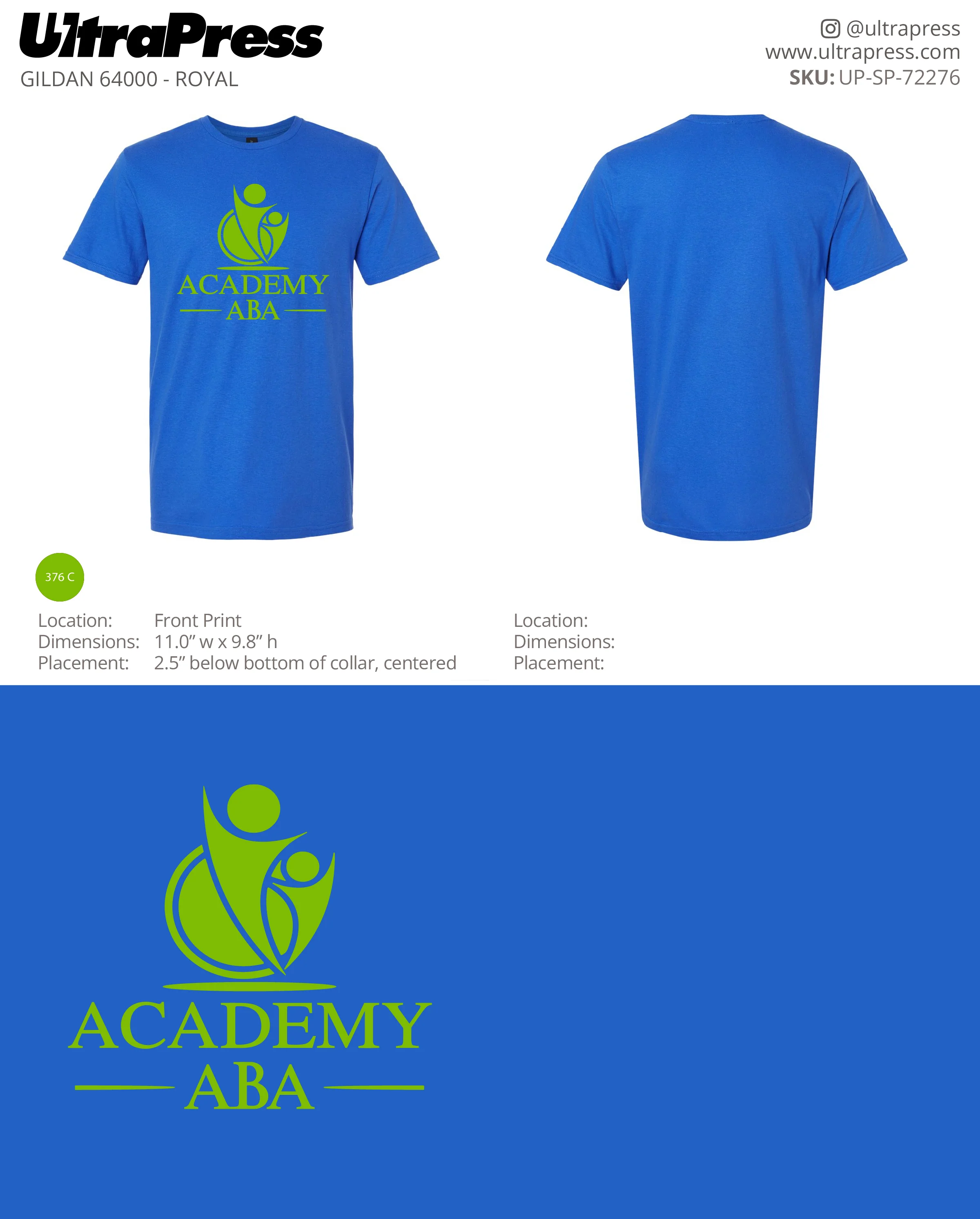 UP-SP-72276 Academy ABA - Andy Margow 100 Pieces Package (Bulk) - Image 2